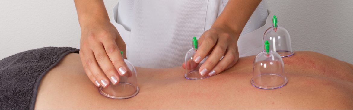 Cupping physical therapy clifton Park
