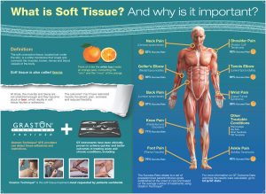 What is Soft Tissue and Why it is Important?