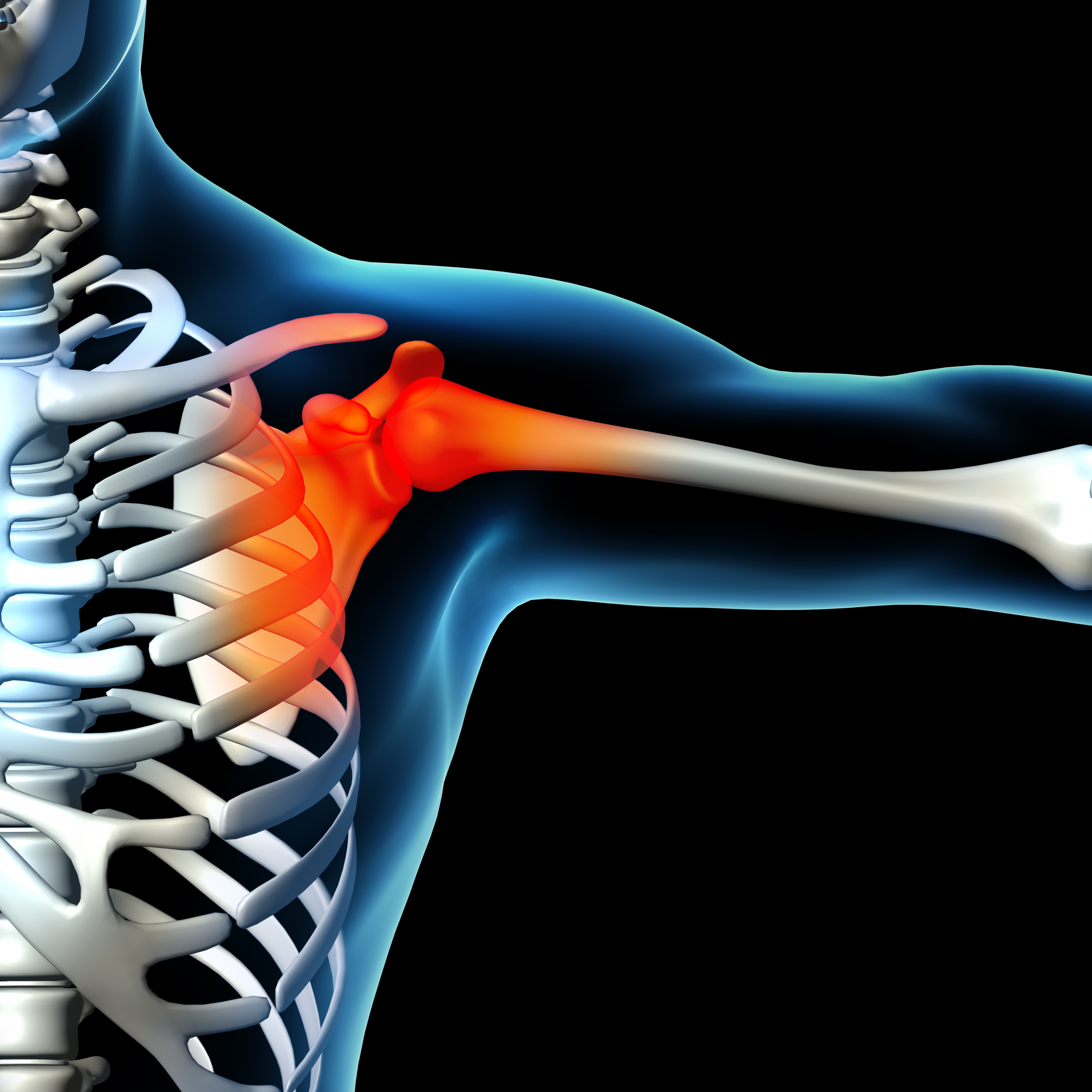 Human shoulder pain with the anatomy of a skeleton shoulder