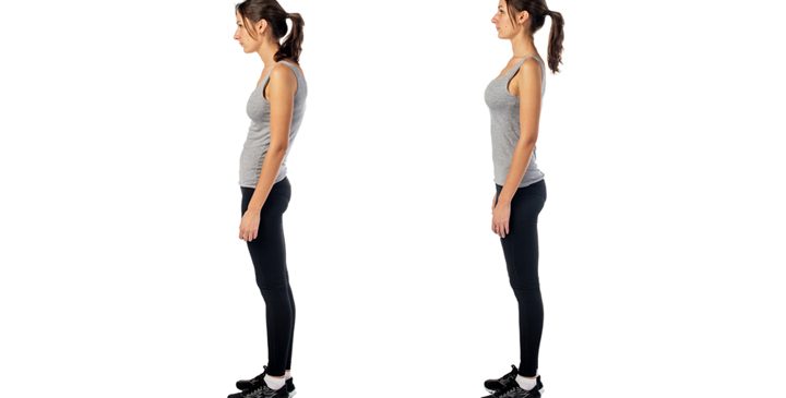 Posture Therapy to Reduce Your Pain Now!